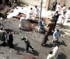 Quetta Civil Hospital Attack Killed Dozens in Bomb Blast Quetta Civil Hospital Attack Killed Dozens in Bomb Blast